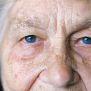 Detecció, prevenció i tractament de la degeneració macular associada a l'edat