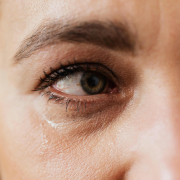 Aquests són els símptomes i el tractament de la conjuntivitis