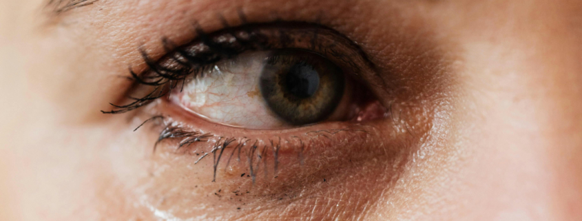 Aquests són els símptomes i el tractament de la conjuntivitis