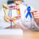 Prevenció càncer de colon