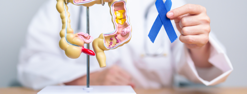 Prevenció càncer de colon